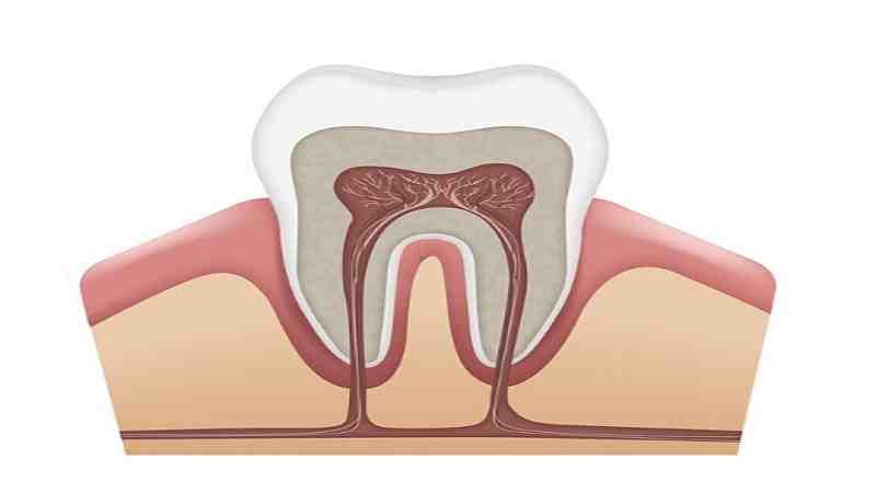 Root Canals